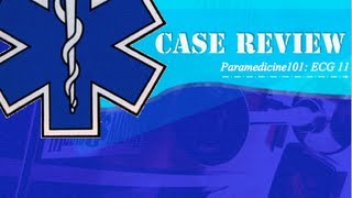 Paramedicine101 ECG Case 11 [upl. by Krid764]