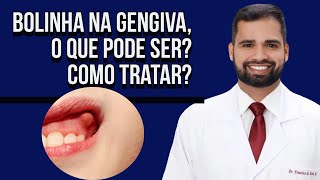 BOLINHA na GENGIVA o que pode ser Como tratar Tudo nesse vídeo dentista tratamentodecanal [upl. by Lawtun]