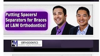 Putting Spacers Separators for Braces [upl. by Cheri]