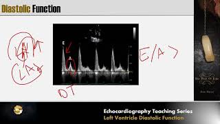 Stroke Volume amp Cardiac Output  702 CVS PHYSIOLOGY [upl. by Cyna]