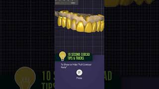 10 second exocad tip press “F” to quick hideshow jaw scans dentalcad smiledesign [upl. by Yentrac]