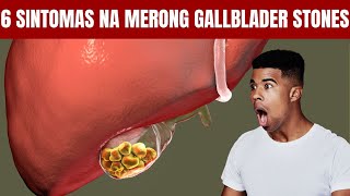 6 Sintomas ng Gallbladder Stone Siguradong Di Mo Aakalain [upl. by Derick342]