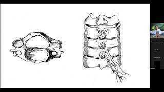 İON 475 Lecture Erişken Cervical Laminoplasty How do I do it 21102024 [upl. by Linneman805]