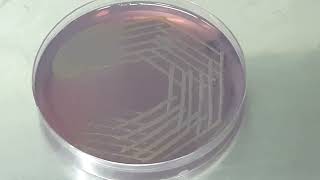 Stenotrophomonas maltophilia colony morphology on CLED agar [upl. by Bucky148]