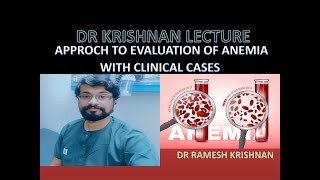 Approch to Evaluation of Anemia With Clinical cases part 1 Microcytic Anemia [upl. by Shalne]