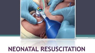 NEONATAL RESUSCITATION PEDIATRICS BSc NURSING GNM medical nursing physiology pediatrics [upl. by Aryt]