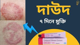 Derobin cream।।ডেরোবিন মলম।।দাউদ এর সব থেকে ভালো ক্রিম।। দাদ দূর করার উপায়।। দাউদ এর ঔষুধ।। [upl. by Natale716]