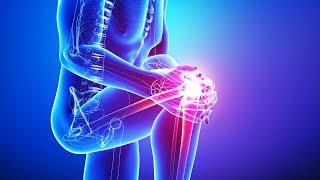 How To Fix Patellofemoral Pain Syndrome [upl. by Halladba361]