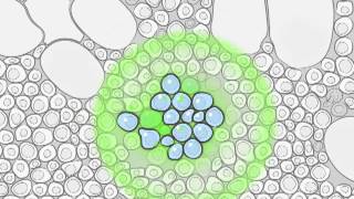 Radium223 and Metastatic Prostate Cancer [upl. by Nnylassej644]