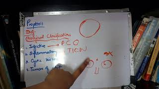 PROPTOSIS very important topic with MNEMONICS to learn [upl. by Eimor]