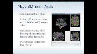 Analyze Mayo 3D Brain Atlas Overview  Webinar [upl. by Rask]