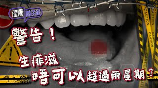 健康關注組｜ EP189 PT1｜警告！生痱滋唔可以超過兩星期？ ｜ 痱滋 ｜ 口腔癌 ｜ 敖嘉年 ｜ 黃芳雯 ｜ HOY TV 77台 [upl. by Reynolds]