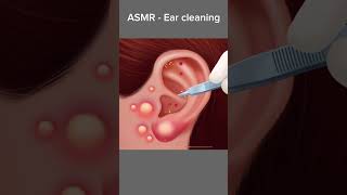 ASMR  Ear Cleaning asmr satisfying shorts viral acnetreatment [upl. by Liarret]