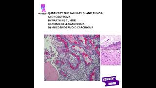 Histopathology questions histopathology mbbs md pathologyacademy draditikumar [upl. by Aicelet]