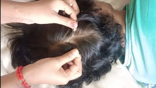 Scalp Searching for Sleep ASMR Tingles [upl. by Aicetel]