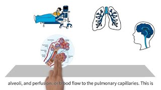 MedEd capnography byte 4 Ventilation perfusion mismatching [upl. by Catina934]