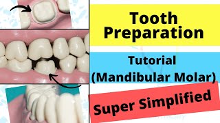 Mandibular Molar Crown Preparation Demonstration [upl. by Raama]