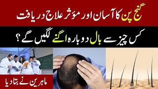 Scientists Discover New Cure for Baldness Using Natural Sugar [upl. by Mosera]