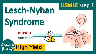 LeschNyhan syndrome  What are the symptoms of LeschNyhan syndrome  Treatment options  USMLE [upl. by Arvie675]