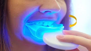 Top 5 best teeth whitening products 2023 [upl. by Oetsira862]