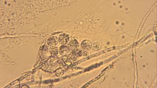 Releasing Oospores from Oogonium Oomycetes [upl. by Spragens]