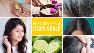 Itchy Scalp Treatments  Remedies For Dandruff Lice and Scalp Acne [upl. by Carmelita]