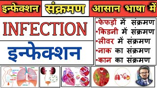 Infection  Classification of Infection  Hospital Acquired Infection  noshocomial infection [upl. by Ena439]