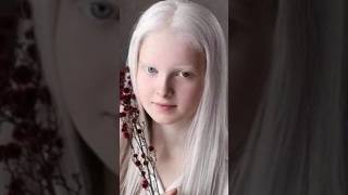 Albino Wonders animals albinism [upl. by Bent]