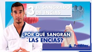 ¿ENCÍAS SANGRANTES Causas y tratamiento del sangrado de encías  Shorts [upl. by Christianson967]