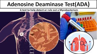 Adenosine Deaminase Test  Clear overview Tuberculosis ADAtestADAmlsmedilabacademy [upl. by George971]