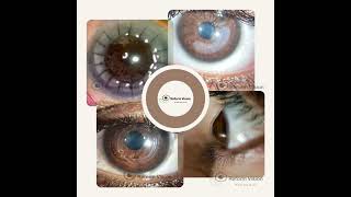 RGP Lenses  Reform vision  Rose K2 Lenses  Prose Lenses  Scleral Lenses [upl. by Hazmah]