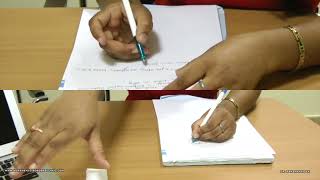 Writers Cramp  Showing dystonic posturing of index finger [upl. by Lela274]