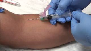 Phlebotomy Syringe Draw Procedure  Blood Collection RxTN [upl. by Colp2]