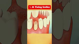 Fixing Smiles vital dentist dentalcare [upl. by Malamut974]