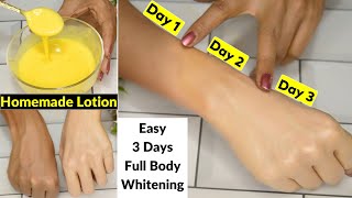 I applied👆this Skin Whitening Lotion On Dark HandsIn 3 Days Dark Dull Skin Got Fair White amp Glowing [upl. by Ailehpo617]