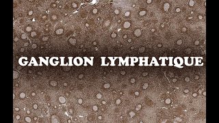 LE GANGLION LYMPHATIQUE profil Immuno 1  HISTOLOGIE [upl. by Ettennal]