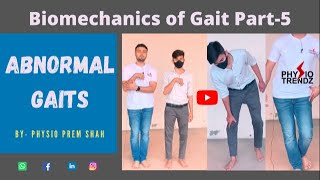 Antalgic gait Hemiplegic gait All Abnormal Gait Demonstration Gait biomechanics [upl. by Hannahsohs]