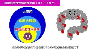 食中毒啓発ファイル Ｆｉｌｅ6 腸管出血性大腸菌食中毒（Ｏ１５７など） [upl. by Kotz243]