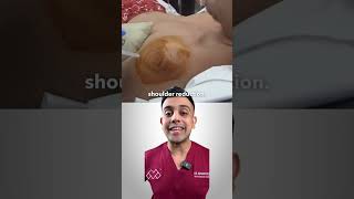 How Can You Fix A Dislocated Shoulder [upl. by Aihtennek]