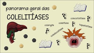 Introdução a Colelitíase coledocolitíase colangite colecistites síndrome de Mirizzi [upl. by Dnama]