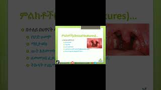 Tonsillitis Explained Symptoms Causes and Treatment Tonsillitis HealthTips የቶንሲልኢንፌክሽን [upl. by Yrolam814]