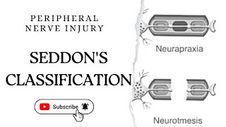 Seddons Classification of nerve injury  Peripheral nerve injury neuro neurology orthopedics [upl. by Yboc]