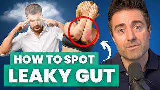 8 Signs Your Gut is LEAKY [upl. by Avenej]