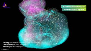 3Dimmunofluorescence of human cerebral organoid stained with Ki67 βTubulin 3 and SOX2 antibodies [upl. by Euqininod]