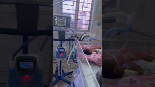 Newborn baby on ventilation in SNCUNICU sncu nicubaby nicu [upl. by Farlay]