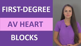 FirstDegree AV Heart Block Nursing NCLEX ACLS ECGEKG Prolonged PR Interval [upl. by Tristam]