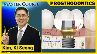 Master Course Season2 PROSTHODONTICS Selecting Abutments for the Posterior Region [upl. by Shields]