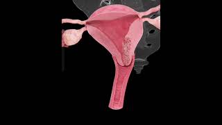 Understanding The Endometrial Cancerwomenhealtbiologyscience viralshorts [upl. by Nawek]