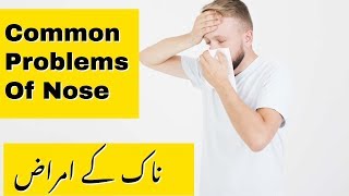 Diseases of Nose  Common Nose Problems [upl. by Rexanna]