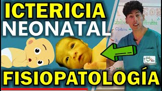 ICTERICIA NEONATAL FISIOPATOLOGÍA  GuiaMed [upl. by Nired169]